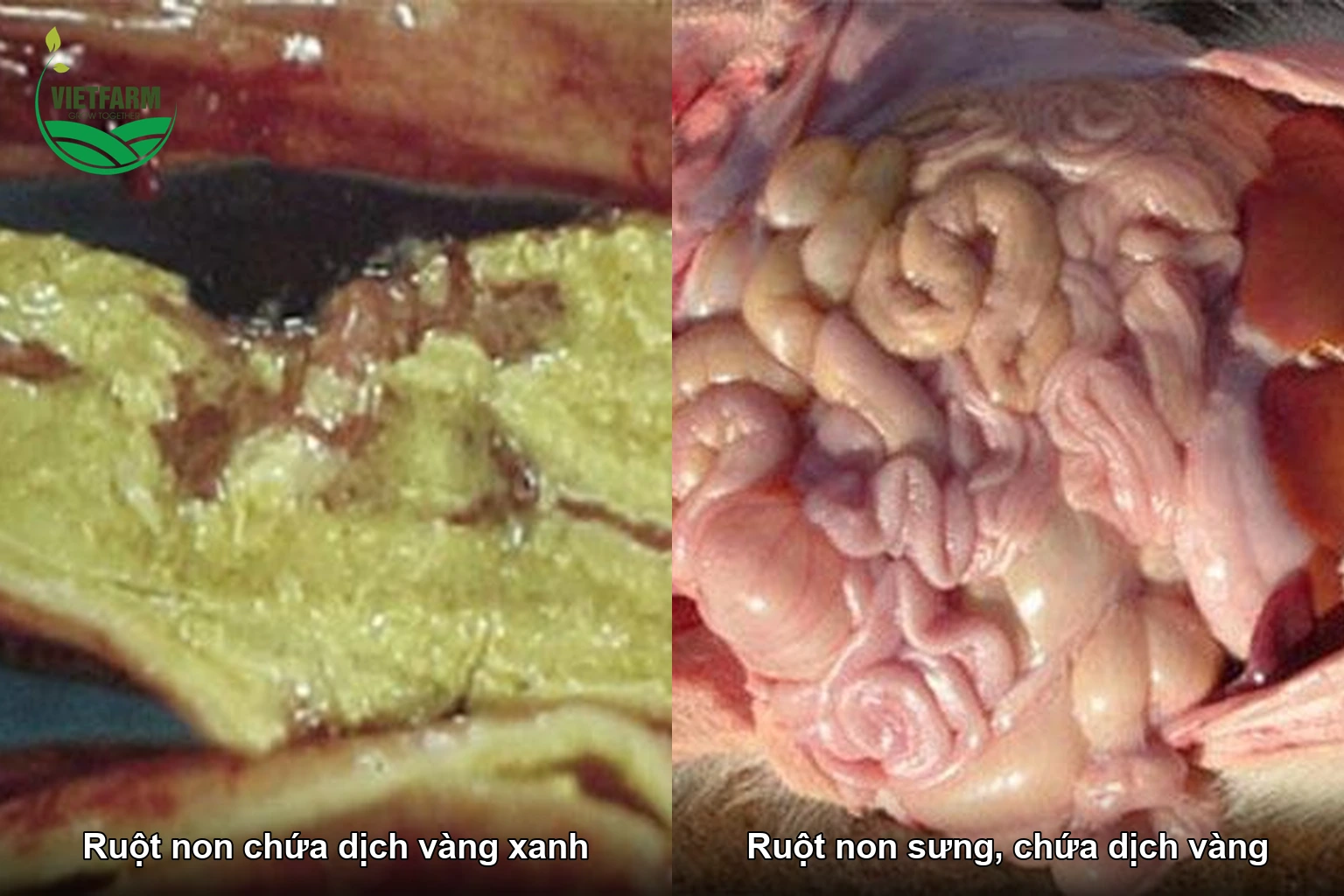 Ruột non heo con mắc cầu trùng sưng, chứa dịch màu vàng xanh.