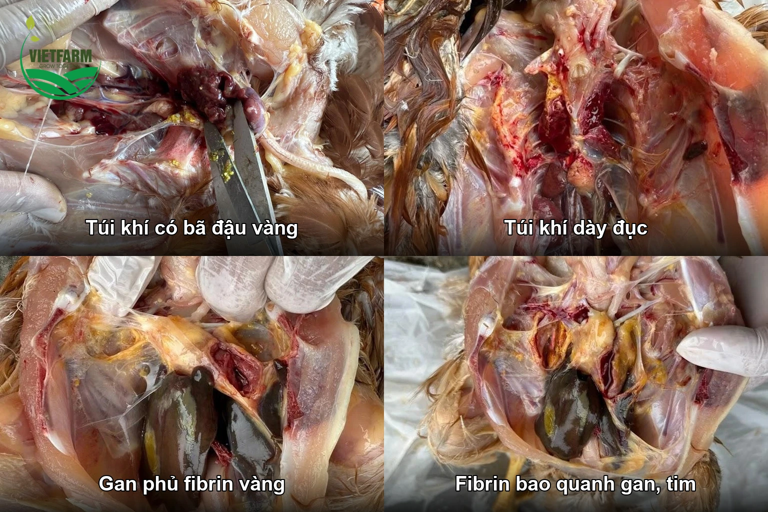 Bệnh tích gà mắc CRD khi mổ khám: túi khí dày đục có bã đậu vàng, gan và xoang bụng phủ fibrin