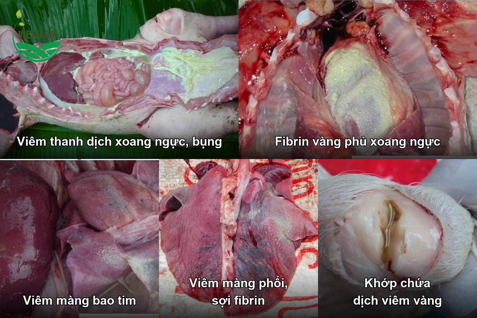 Bệnh tích heo mắc Glasser: viêm thanh dịch xoang ngực, fibrin vàng, viêm màng bao tim, màng phổi và khớp