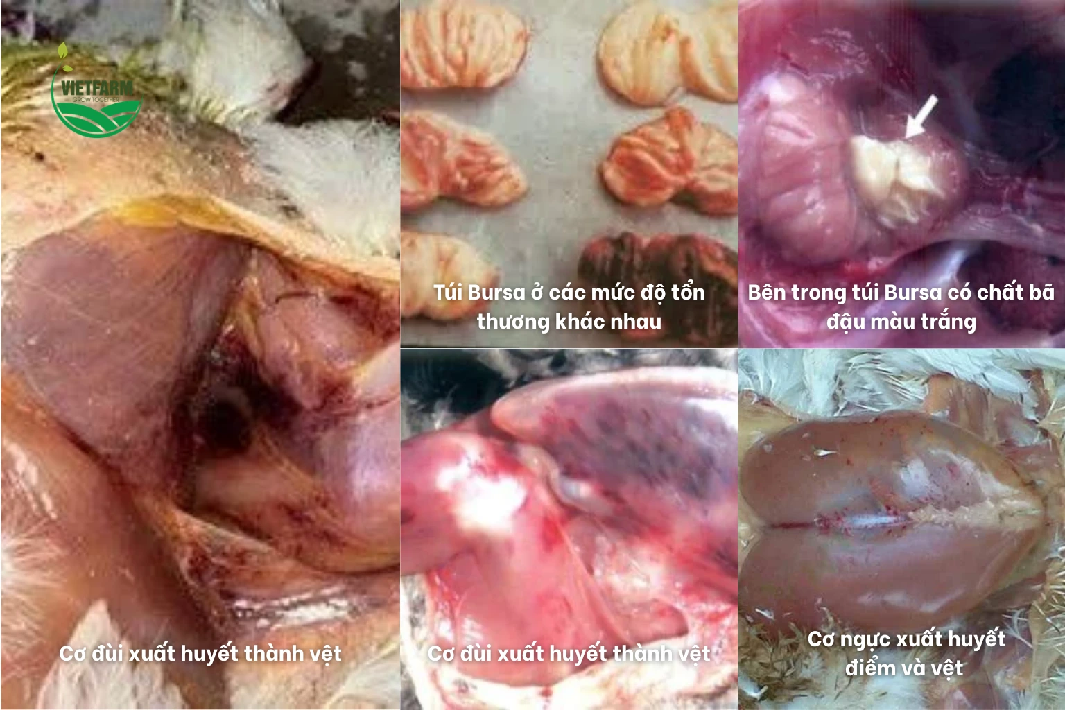 Bệnh tích Gumboro: túi Bursa sưng, xuất huyết cơ đùi và cơ ngực ở gà
